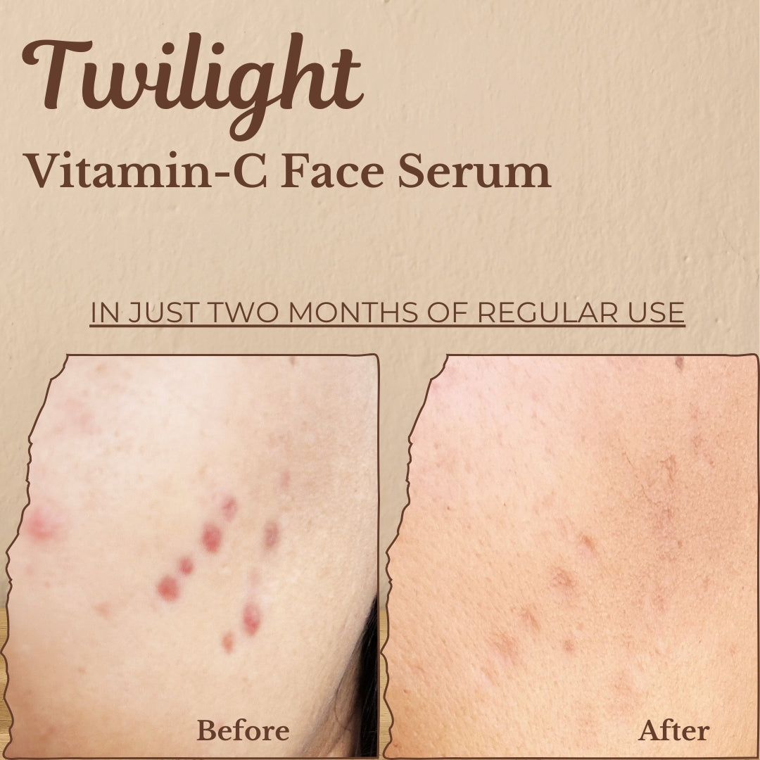 Twilight - Vitamin C